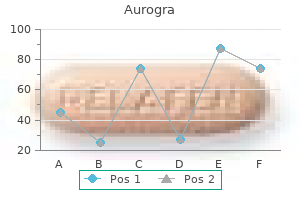 buy discount aurogra 100 mg on-line