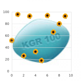 Chromosome 3, monosomy 3q13