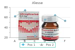 buy discount alesse 0.18mg line