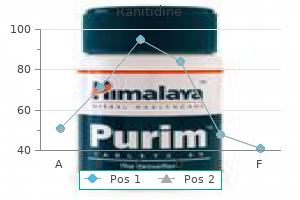 discount 300 mg ranitidine