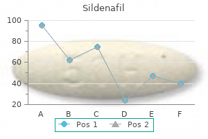 order sildenafil 50 mg with mastercard