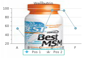 buy wellbutrin 300 mg without prescription