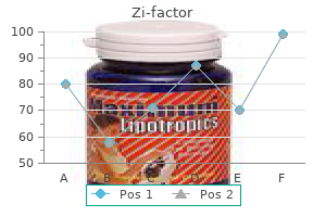 order zi-factor on line amex