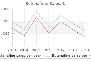 cheap butenafine line