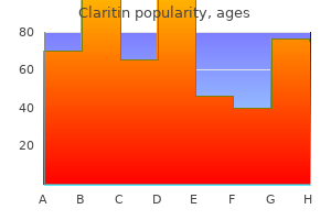 quality 10 mg claritin