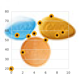Acute posterior multifocal placoid pigment epitheliopathy