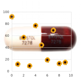 Microcephaly cardiac defect lung malsegmentation