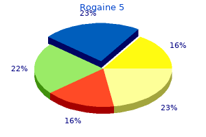 best 60ml rogaine 5