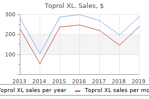 generic toprol xl 50 mg on line