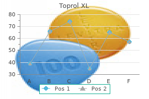 order generic toprol xl pills