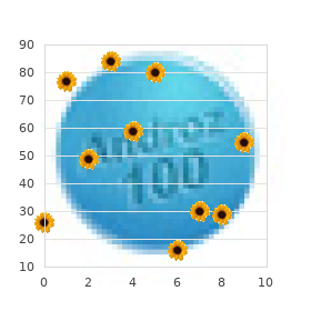 Systemic lupus erythematosus