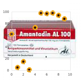 Cholelithiasis