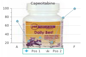 purchase capecitabine american express