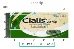 discount tadacip 20mg fast delivery