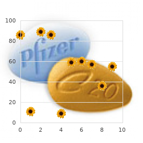 Transient global amnesia