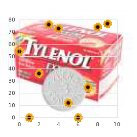 Rubinstein Taybi like syndrome