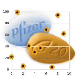 Chromosome 21, uniparental disomy of