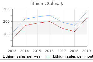 cheap 150 mg lithium free shipping