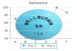 buy naltrexone 50 mg on-line