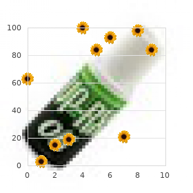 Hypotonic sclerotic muscular dystrophy