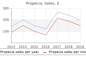 cheap propecia 5 mg fast delivery