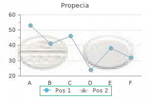 cheap propecia online amex